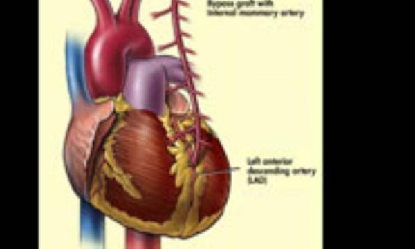 پیش درمانی با دوز بالای فولات در حفاظت از ماهیچه قلب مؤثر است